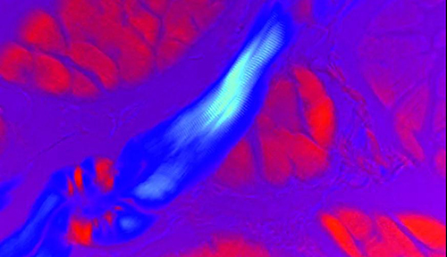 一文速览:显微镜常见的7种观察方式 一文速览:显微镜常见的7种观察方式