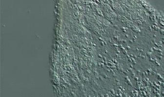 一文速览:显微镜常见的7种观察方式 一文速览:显微镜常见的7种观察方式